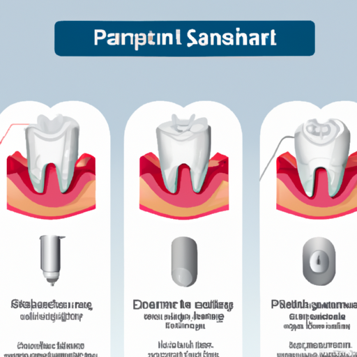 אינפוגרפיקה המסבירה את תהליך ניתוח השתלת שיניים.